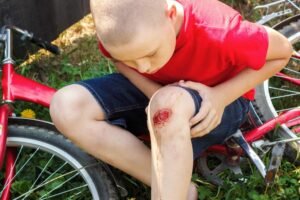 Common Sports Injuries 6 Abrasion injury